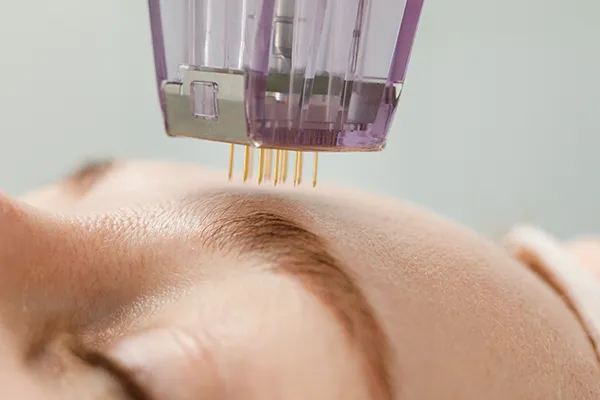 Botox & Fillers